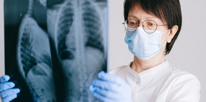 Zastosowanie mobilnego aparatu rentgenowskiego (RTG)